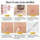 1/11Pcs Acne Pimples Blackhead Remover Clip Ultra-fine Tweezers Black Dots Blackhead Extractor Acne Needle Facial Cleaner Skin