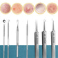 1/11Pcs Acne Pimples Blackhead Remover Clip Ultra-fine Tweezers Black Dots Blackhead Extractor Acne Needle Facial Cleaner Skin