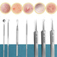 1/11Pcs Acne Pimples Blackhead Remover Clip Ultra-fine Tweezers Black Dots Blackhead Extractor Acne Needle Facial Cleaner Skin